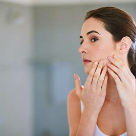 Wat kun je zelf doen aan acne?