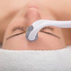 Wat is micro needling?