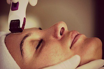 Dermaroller-voordelen