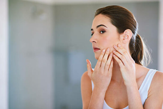 blog-acne-543x362